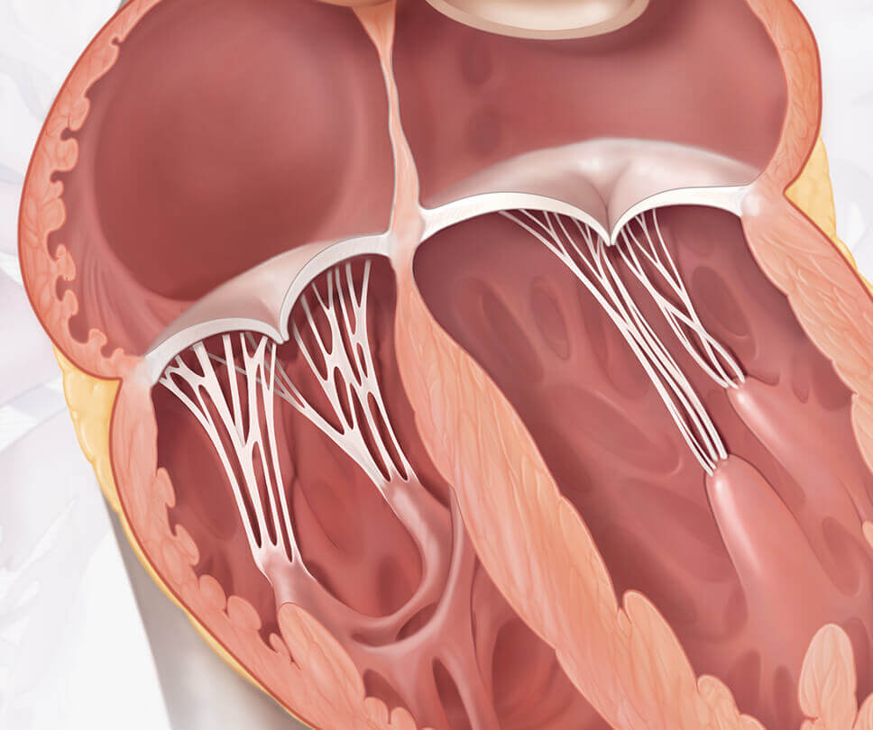 Healthy Heart